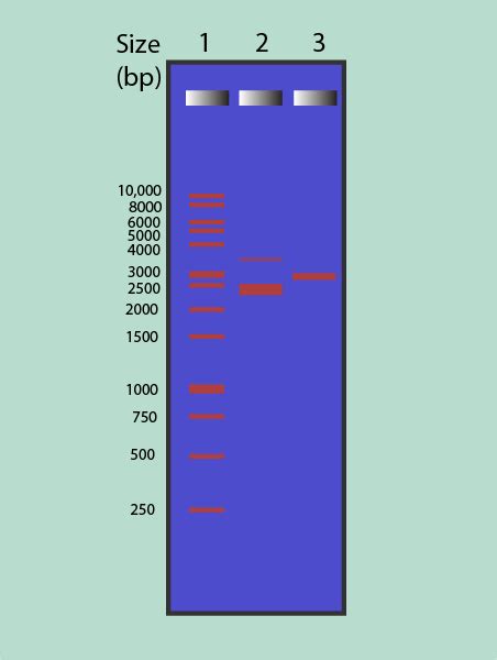 gel electrophoresis results|How to Interpret DNA Gel Electrophoresis Results .